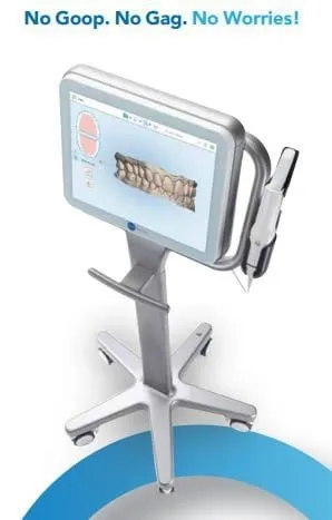 ITERO SCANNER — Valiente Dental