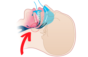 Snoring illustration