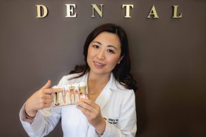 Cosmetic Dentist showing dental crown for smile makeover for cosmetic dentistry